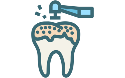 CRATEX Products for Dental Labs